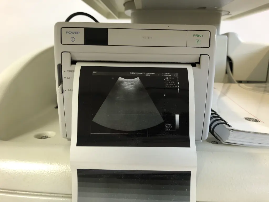 GE Vivid SN-6270-Printer.webp