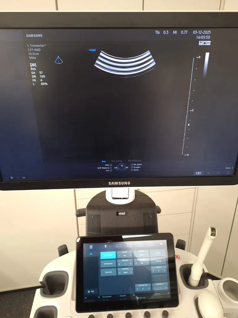 WhatsApp Bild 2025-12-03 um 16.00.30_de9913ca.webp